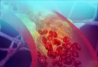 Cholesterol: The Good, the Bad and the Dietary